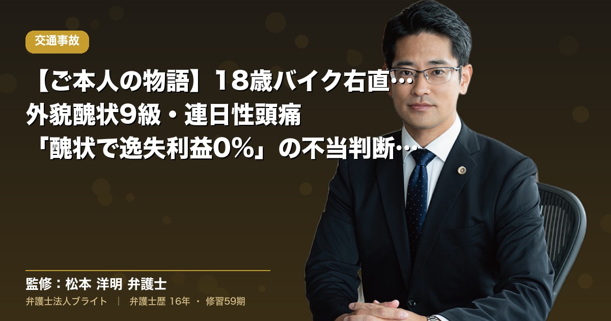 【ご本人の物語】18歳バイク右直事故で外貌醜状9級・連日性頭痛｜「醜状で逸失利益0%」の不当判断に控訴方針（弁護士法人ブライト 松本 洋明 監修）