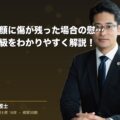 交通事故で顔に傷が残った場合の慰謝料と後遺障害等級をわかりやすく解説!(弁護士法人ブライト 松本 洋明 監修)